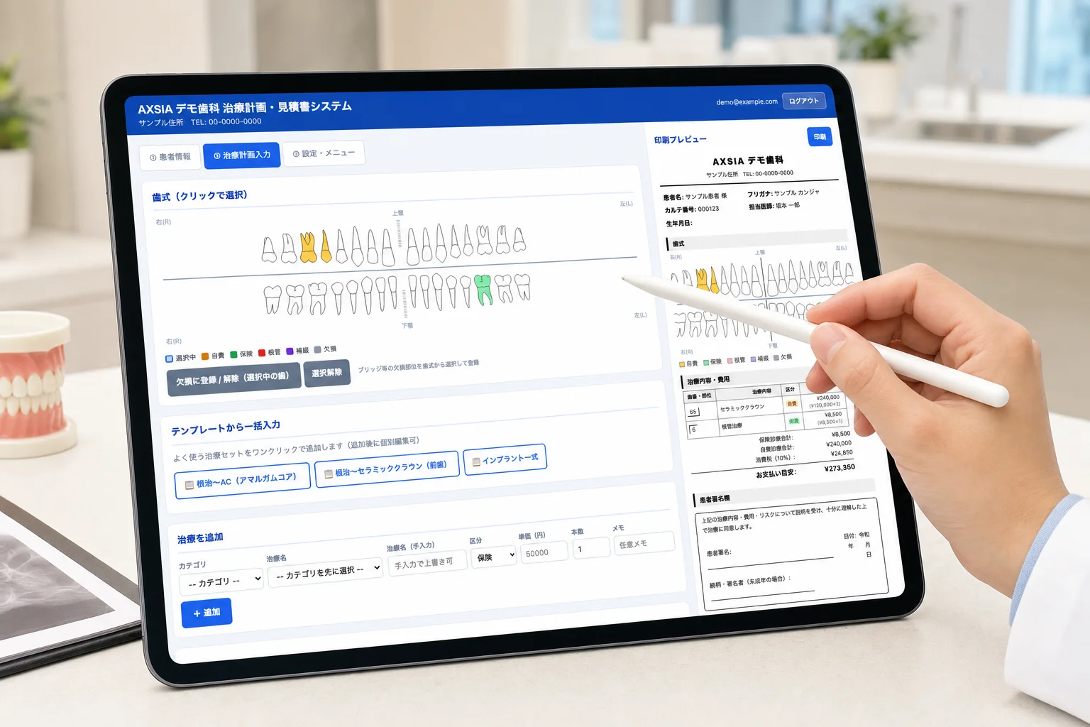 歯科医院のカウンターで、歯科医師がiPadの歯式と治療計画をペンで確認している様子